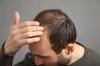 Spain vs Turkey hair transplant comparison guide – cost, tech and hidden risks