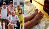 British mother, 66, nearly died after contracting Legionnaires' disease when hotel granite worktop crushed her foot during holiday to Barbados