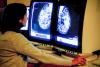 Lifestyle factors responsible for quarter of healthy years lost to breast cancer