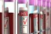 Suriname: Doctors urge media to be more careful when publishing material on HIV/AIDS
