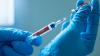Latest outbreaks worldwide May 2026 anyone travelling should be aware of