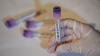 Western Cape monitors four people linked to hantavirus outbreak