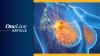 <![CDATA[Robotic Mastectomy Marks New Milestone in Breast Cancer Care in the Mountain West]]>