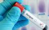 Dept. of Health works to contain spread of dengue cases in the territory