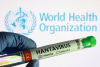 Hantavirus risk remains low for public in Azerbaijan