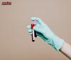 #hauora: Too Young, Too Late: Study Reveals Alarming Delays in Bowel Cancer Diagnosis for Young New Zealanders