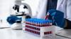 Pfizer receives EC approval for Hympavzi to treat haemophilia