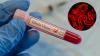 Uganda Tightens Ebola Surveillance as DR Congo Outbreak Sparks Regional Concern