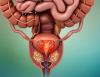 Stockholm3 blood test may offer more accurate prostate cancer detection