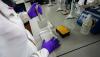 New study identifies priority fungal infections in patients with TB-like symptoms
