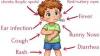 Ministry of Health confirms 12 measles cases in Belize since the start of the year