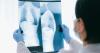 Singapore, Bhutan partner on rural chest X-ray AI
