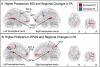 The new science of 'dad brain'