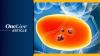 <![CDATA[EU CHMP Issues Positive Opinion for Perioperative Pembrolizumab/Enfortumab Vedotin in Cisplatin-Ineligible MIBC]]>