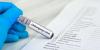 France records over 90 cases of mosquito-borne diseases in May