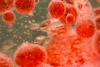 <![CDATA[The Lowest-Ever Hazard Ratio in Multiple Myeloma Bispecific Trials?]]>