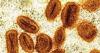 2 scientists charged with bringing deactivated mpox virus into the US and lying to authorities