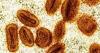 2 scientists charged with bringing deactivated mpox virus into US, lying at Detroit Metro Airport