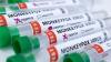 Foreign Researchers Charged With Allegedly Smuggling Monkeypox Virus Into US