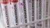 Federal researchers charged with smuggling mpox virus samples through Detroit Metro Airport