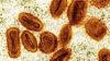 2 scientists charged with bringing deactivated mpox virus into U.S. and lying to authorities