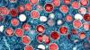 NIH researchers charged with attempting to smuggle vials of mpox virus into the US