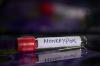Federal complaint accuses 2 researchers of bringing monkeypox vials into US