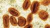 Scientists charged with bringing deactivated mpox virus into US, lying to authorities