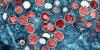 Two scientists charged with smuggling monkeypox virus through Detroit airport
