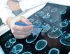 ALS risk varies significantly across U.S. military service branches