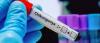 French Guiana: A vaccination campaign launched in response to the spread of chikungunya
