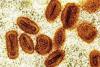 2 scientists charged in bringing deactivated mpox into country