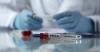 Three returnees from Ebola-hit African nations kept in home isolation in Chhattisgarh's Durg