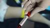 Scientists Accused Of Smuggling Contagious Pathogens From Africa Into US