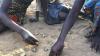 Zambia’s poisoned children have waited long enough. Africa needs to act.