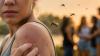 Why mosquitoes keep choosing you over everyone else