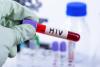 Togo's HIV Gains Are Real. So Are Concerns About Emerging Drug Resistance.