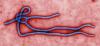 Saint Lucia updates Ebola preparedness plan as Caribbean strengthens border screening