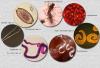 GHS to reach eight million people with drugs on Neglected Tropical Diseases