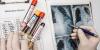 Beyond Aspirin: Exploring New Antithrombotic Options in Kawasaki Disease
