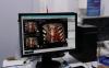Mongolia Launches First 512-Slice AI CT Scanner