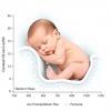 Postnatal Bilirubin Rise Predicts Newborn Health