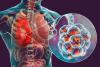 Cayman islands: No additional cases of Legionnaires disease