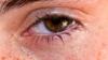 Tears: A Well of Diagnostic Info, No Crying Required