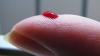 Blood: Why Medicine’s Oldest Sample Has Been Underestimated