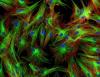 Researchers uncover key mechanism driving chronic Sjögren disease