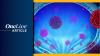 <![CDATA[Perioperative Pembrolizumab/Enfortumab Vedotin Approved in Europe for Cisplatin-Ineligible MIBC]]>