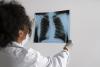 The next frontier in South Africa’s TB response is health system reform