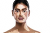 World Vitiligo Day – Cultural Stigmas Surrounding Chronic Skin Conditions