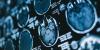 Researchers find evidence connecting a specific blood protein to brain tissue loss